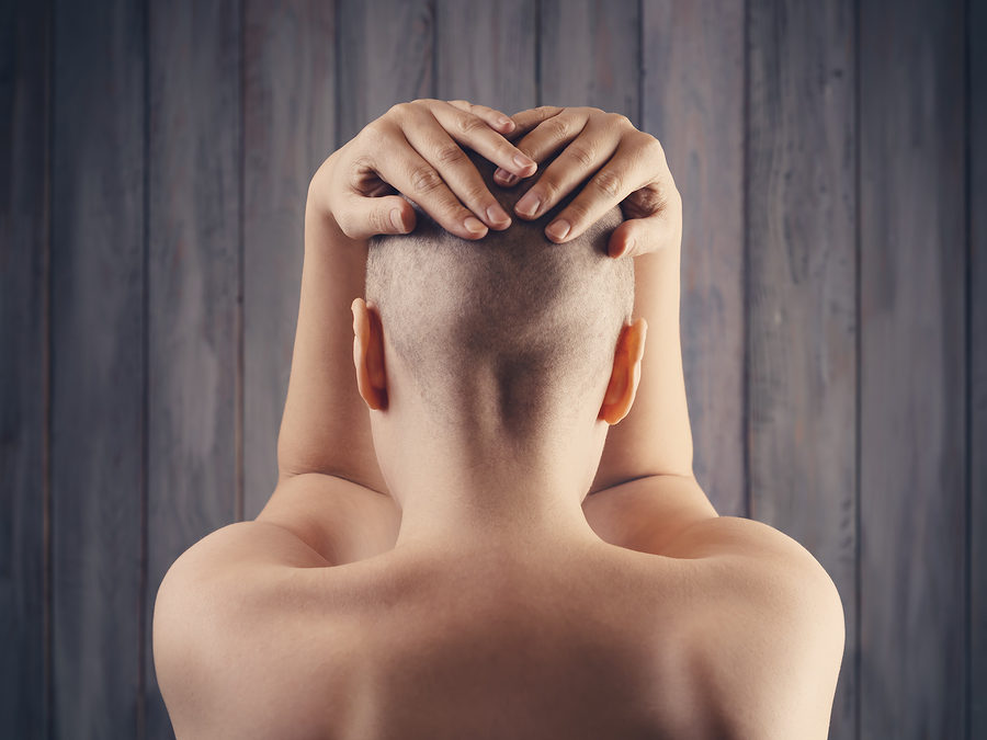 Alopecia totalis: der kreisrunde Haarausfall