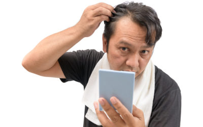 Alopezie Forum – Was tun bei Haarausfall