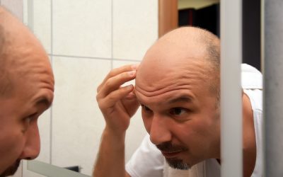 Anhaltender Haarausfall – was tun, wenn nichts hilft?