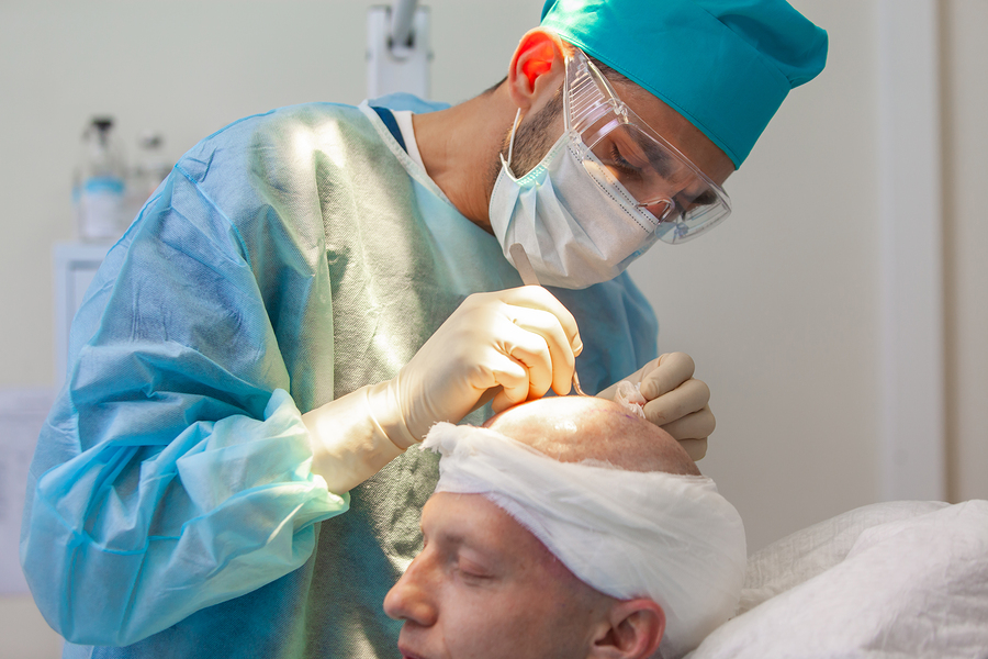 DHI Haartransplantation Methode