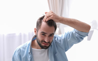 Diffuser Haarausfall – Was tun bei Haarausfall