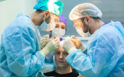 Haartransplantation bei Geheimratsecken – Behandlungsmethoden