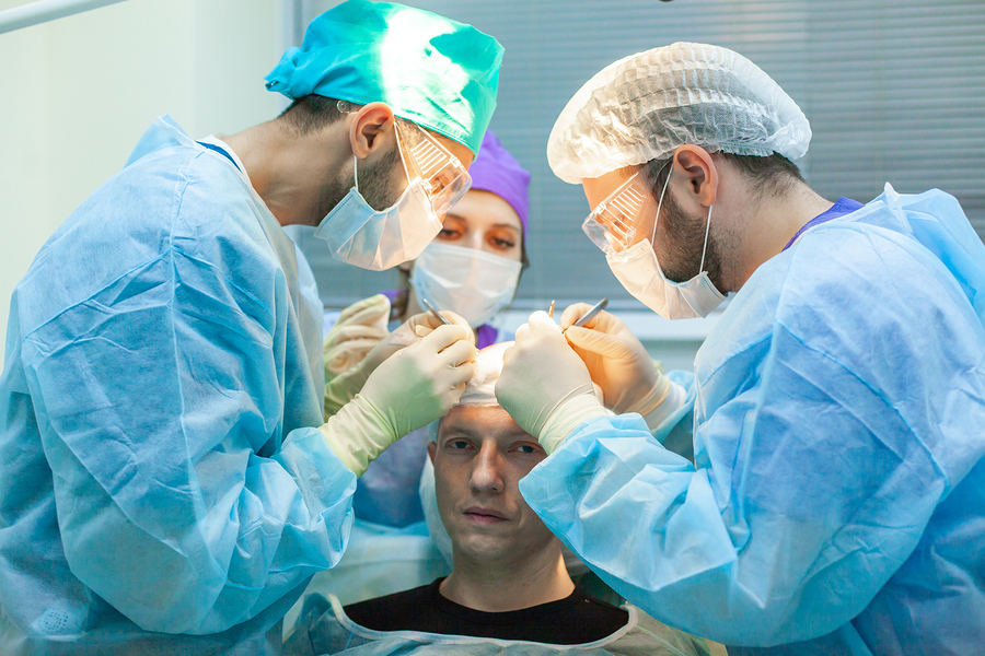 Haartransplantation bei Geheimratsecken – Behandlungsmethoden