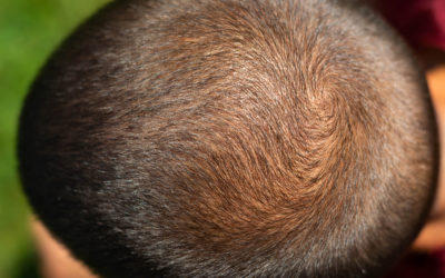 Haarwachstum pro Monat – beschleunigen, anregen, fördern