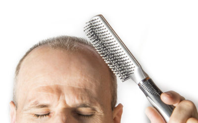Hormonell bedingter Haarausfall bei Frau & Mann