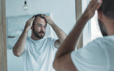 Hormoneller Haarausfall – Ursachen & Mittel dagegen