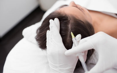 Mesotherapie bei Haarausfall