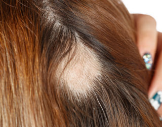 Alpecin Coffein Shampoo Gegen Haarausfall Haarausfall Hilfe