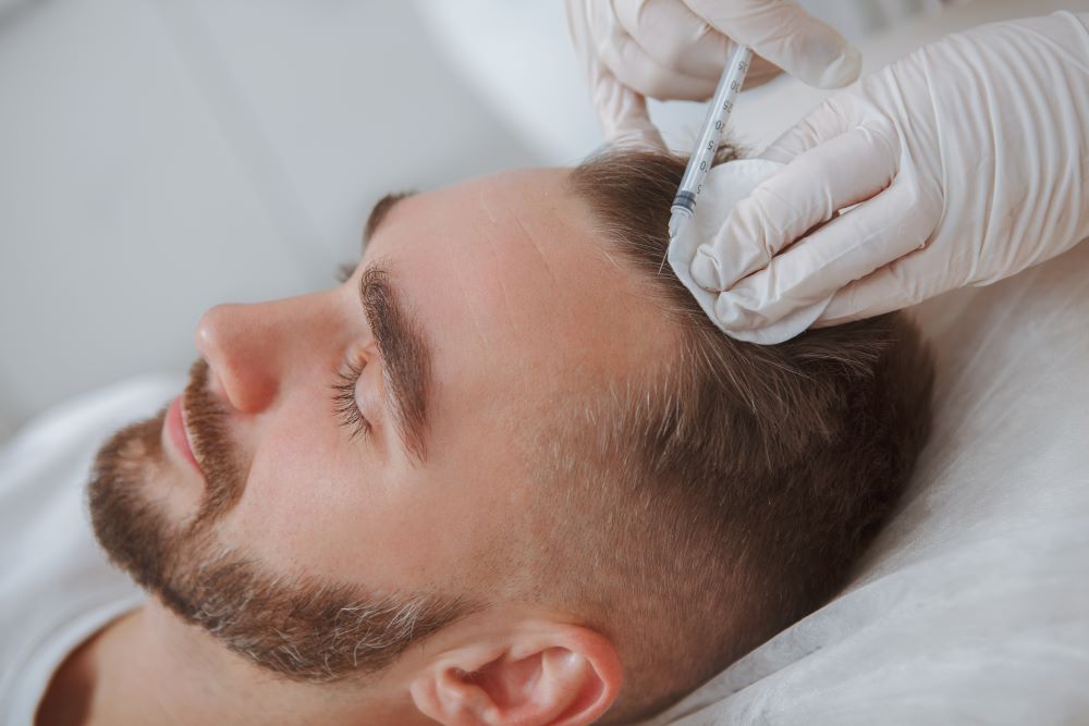 Wie PRP-Behandlung bei Haarausfall hilft: Ein umfassender Überblick