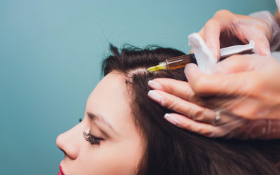 PRP – Haarausfall mit Eigenbluttherapie stoppen