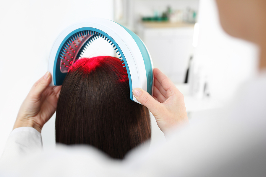 Softlaser Therapie gegen Haarausfall